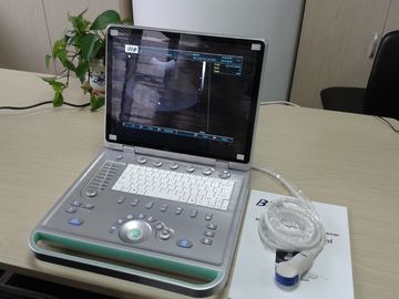 3D 디지털 방식으로 휴대용 퍼스널 컴퓨터 온갖 조사를 가진 휴대용 초음파 스캐너